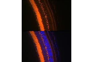 Immunofluorescence analysis of mouse eye using V Rabbit mAb (ABIN7271313) at dilution of 1:100 (40x lens). (VAMP2 Antikörper)