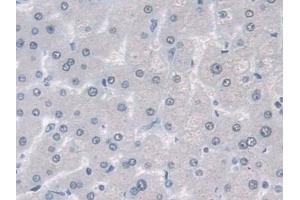 Immunohistochemistry (IHC) image for anti-Ubiquitin (Ub) (AA 1-229) antibody (ABIN7443803)