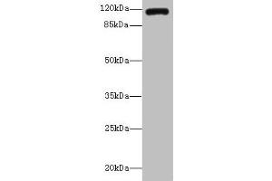 Western blot All lanes: INVS antibody IgG at 14 μg/mL + K562 whole cell lysate Secondary Goat polyclonal to rabbit IgG at 1/10000 dilution Predicted band size: 118, 100, 11 kDa Observed band size: 118 kDa