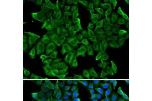Immunofluorescence analysis of MCF-7 cells using REG3G Polyclonal Antibody (REG3g Antikörper)