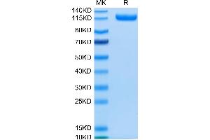 SDS-PAGE (SDS) image for CUB Domain Containing Protein 1 (CDCP1) (AA 30-666) protein (Fc Tag) (ABIN7274294)