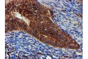 Image no. 6 for anti-Epsin 2 (EPN2) antibody (ABIN1498051) (Epsin 2 Antikörper)