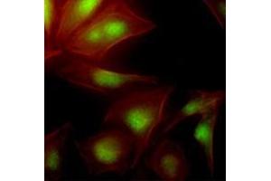 Immunofluorescenitrocellulosee of human HeLa cells stained with Phalloidin-TRITC (Red) for Actin staining and monoclonal anti-human UBE2S antibody (1:500) with Alexa 488 (Green).