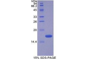 SDS-PAGE (SDS) image for Vasoactive Intestinal Peptide (Vip) (AA 28-159) protein (His tag) (ABIN1879991) (Vip Protein (AA 28-159) (His tag))