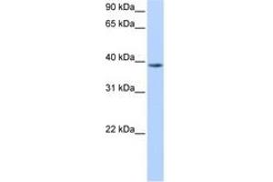 Image no. 1 for anti-Nudix (Nucleoside Diphosphate Linked Moiety X)-Type Motif 13 (NUDT13) (N-Term) antibody (ABIN6738501) (NUDT13 Antikörper  (N-Term))