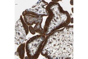 Immunohistochemical staining of human placenta with PTCD1 polyclonal antibody  shows strong cytoplasmic positivity in trophoblastic cells. (PTCD1 Antikörper)