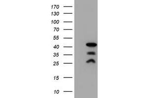Western Blotting (WB) image for anti-PDZ and LIM Domain 2 (PDLIM2) antibody (ABIN1500127) (PDLIM2 Antikörper)