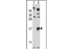 Western blot analysis of GYPB (arrow) using rabbit polyclonal GYPB Antibody (Center) (ABIN657621 and ABIN2846617). (CD235b/GYPB Antikörper  (AA 22-51))