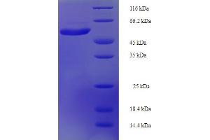 SDS-PAGE (SDS) image for Interleukin 22 Receptor, alpha 1 (IL22RA1) (AA 250-573), (Cytosolic), (partial) protein (His-SUMO Tag) (ABIN5711543) (IL22 Receptor alpha 1 Protein (AA 250-573, Cytosolic, partial) (His-SUMO Tag))