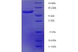 SDS-PAGE (SDS) image for Interleukin 22 Receptor, alpha 1 (IL22RA1) (AA 250-573), (Cytosolic), (partial) protein (His-SUMO Tag) (ABIN5711543)