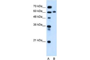 WB Suggested Anti-KIAA1754L Antibody Titration:  0. (ITPRIPL1 Antikörper  (C-Term))