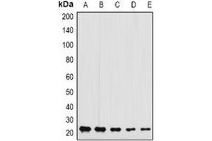 Western blot analysis of GFER expression in MCF7 (A), A375 (B), mouse liver (C), mouse testis (D), rat brain (E) whole cell lysates. (GFER Antikörper)