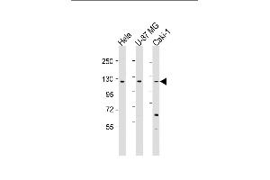 All lanes : Anti-STARD8 Antibody (N-Term) at 1:1000-1:2000 dilution Lane 1: Hela whole cell lysate Lane 2: U-87 MG whole cell lysate Lane 3: Caki-1 whole cell lysate Lysates/proteins at 20 μg per lane. (STARD8 Antikörper  (AA 220-255))