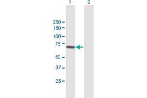 Western Blot analysis of CPT2 expression in transfected 293T cell line by CPT2 MaxPab polyclonal antibody. (CPT2 Antikörper  (AA 1-658))
