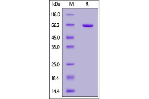 Mouse Nectin-4, Fc Tag on  under reducing (R) condition. (PVRL4 Protein (AA 31-347) (Fc Tag))