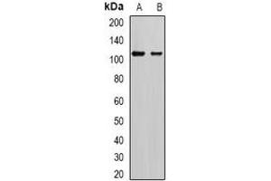 Western blot analysis of AP2-alpha-2 expression in SKOV3 (A), mouse brain (B) whole cell lysates. (AP2A2 Antikörper)