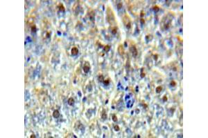 Used in DAB staining on fromalin fixed paraffin-embedded Liver tissue (SSRP1 Antikörper  (AA 6-246))