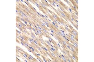 Immunohistochemistry (Paraffin-embedded Sections) (IHC (p)) image for anti-Solute Carrier Family 25 (Mitochondrial Carrier, Adenine Nucleotide Translocator), Member 4 (SLC25A4) (AA 40-298) antibody (ABIN3022646)