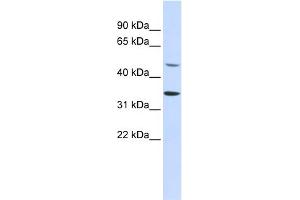 WB Suggested Anti-ZNF398 Antibody Titration:  0. (ZNF398 Antikörper  (Middle Region))