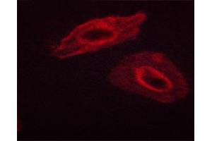Immunofluorescence (fixed cells) (IF/ICC) image for anti-Keratin 8 (KRT8) (pSer432) antibody (ABIN6255334)