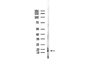 anti-Ribosomal Protein S18 (RPS18) antibody