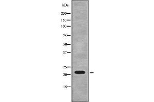 Western blot analysis of RPL18A using A549 whole cell lysates (RPL18A Antikörper  (Internal Region))