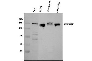 anti-rho-Associated, Coiled-Coil Containing Protein Kinase 2 (ROCK2) (AA 652-923) antibody