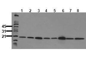 Western Blotting (WB) image for anti-Peptidylprolyl Cis/trans Isomerase, NIMA-Interacting 1 (PIN1) antibody (ABIN126850) (PIN1 Antikörper)