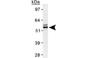 Western blot analysis of TERF2 in HeLa nuclear extract using TERF2 polyclonal antibody . (TRF2 Antikörper)