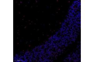 Immunofluorescence of paraffin embedded mouse cerebellum using notch3 (ABIN7074862) at dilution of 1:650 (250x lens) (NOTCH3 Antikörper)