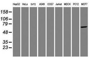 Image no. 5 for anti-Aryl Hydrocarbon Receptor Interacting Protein-Like 1 (AIPL1) antibody (ABIN1496508) (AIPL1 Antikörper)