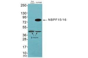 Western blot analysis of extracts from JK cells, using NBPF1/9/10/12/14/15/16/20 antibody. (NBPF12/NBPF1/NBPF1/NBPF9 Antikörper)