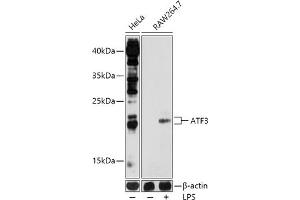 Western blot analysis of extracts of various cell lines, using  antibody  at 1:1000 dilution. (ATF3 Antikörper  (AA 1-181))