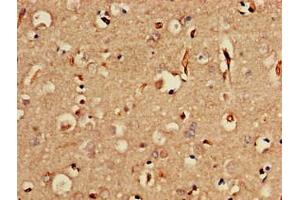 Immunohistochemistry of paraffin-embedded human brain tissue using ABIN7175662 at dilution of 1:100 (SORCS2 Antikörper  (AA 712-786))