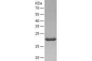 Western Blotting (WB) image for GM2 Ganglioside Activator (GM2A) (AA 26-193) protein (His tag) (ABIN7123178) (GM2A Protein (AA 26-193) (His tag))