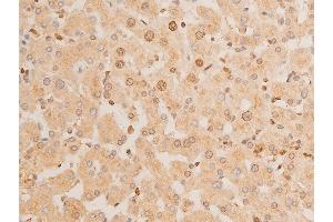 Immunohistochemistry (IHC) image for anti-Tumor Protein P73 (TP73) (pTyr99) antibody (ABIN6256817)