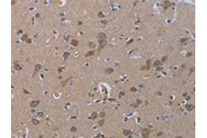 The image on the left is immunohistochemistry of paraffin-embedded Human brain tissue using ABIN7129900(INSIG2 Antibody) at dilution 1/30, on the right is treated with fusion protein. (INSIG2 Antikörper)