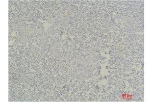 Immunohistochemistry (IHC) analysis of paraffin-embedded Human Tonsil Tissue using Stat4 Polyclonal Antibody. (STAT4 Antikörper)