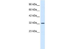Western Blotting (WB) image for anti-SWI/SNF Related, Matrix Associated, Actin Dependent Regulator of Chromatin, Subfamily A, Member 2 (SMARCA2) (Middle Region) antibody (ABIN2775822)