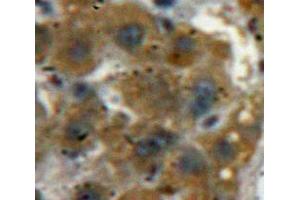 IHC-P analysis of Liver tissue, with DAB staining. (ACP1 Antikörper  (AA 40-158))