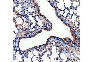 IHC analysis of ALDH1A3 using anti-ALDH1A3 antibody (ABIN5518802). (ALDH1A3 Antikörper  (AA 37-154))