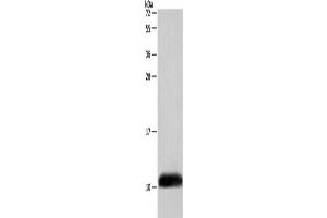 Gel: 10 % SDS-PAGE, Lysate: 40 μg, Lane: A549 cells, Primary antibody: ABIN7129016(COX6B2 Antibody) at dilution 1/500, Secondary antibody: Goat anti rabbit IgG at 1/8000 dilution, Exposure time: 5 seconds (COX6B2 Antikörper)