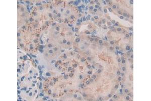 Used in DAB staining on fromalin fixed paraffin- embedded kidney tissue (FASTK Antikörper  (AA 330-511))