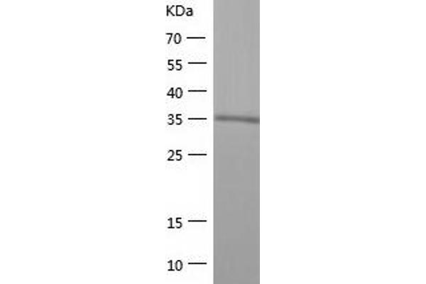 JNK2 Protein (AA 1-382) (His tag)