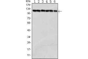Western blot analysis using PARP mouse mAb against Jurkat (1), K562 (2), Hela (3), Raji (4),THP-1 (5) and SW620 (6) cell lysate. (PARP1 Antikörper)