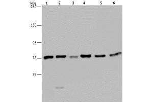 Western Blot analysis of K562, A549, HT-29, 293T, Hela and Jurkat cell using KARS Polyclonal Antibody at dilution of 1:350 (KARS Antikörper)