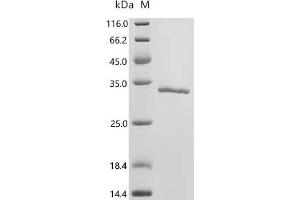 (Tris-Glycine gel) Discontinuous SDS-PAGE (reduced) with 5 % enrichment gel and 15 % separation gel.