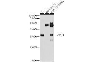 Immunoprecipitation analysis of 300 μg extracts of HeLa cells using 3 μg U2 antibody (ABIN6134442, ABIN6149752, ABIN6149755 and ABIN6217061). (U2AF1 Antikörper  (AA 1-100))