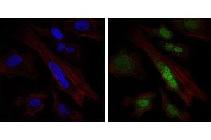 Image no. 1 for anti-SRY (Sex Determining Region Y)-Box 9 (SOX9) antibody (ABIN1501087) (SOX9 Antikörper)