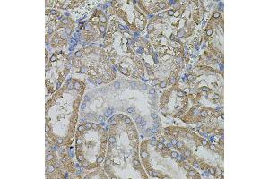 Immunohistochemistry of paraffin-embedded mouse kidney using MMP9 antibody. (MMP 9 Antikörper)